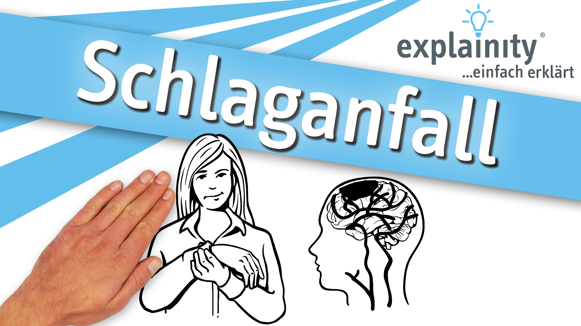 Schlaganfall einfach erklärt